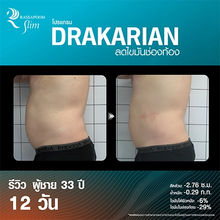 DRAKARIAN สลายไขมันใต้ผิว