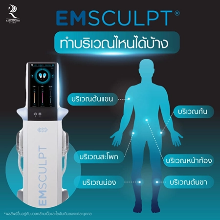 Emsculpt สร้างกล้ามเนื้อ ลดไขมัน