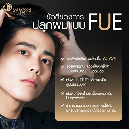 ปลูกผมถาวร FUE