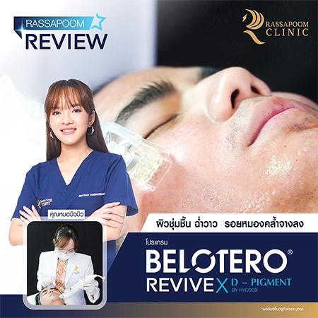 Belotero Revive (คุณนิก คุณาธิป ปิ่นประดับ)