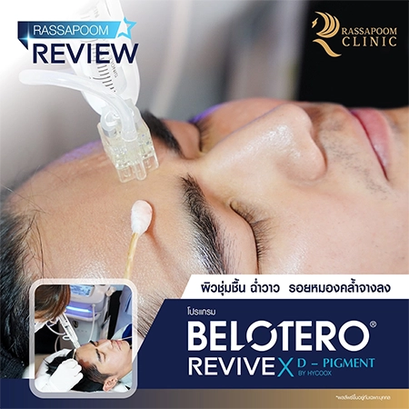 Belotero Revive (คุณนิก คุณาธิป ปิ่นประดับ)