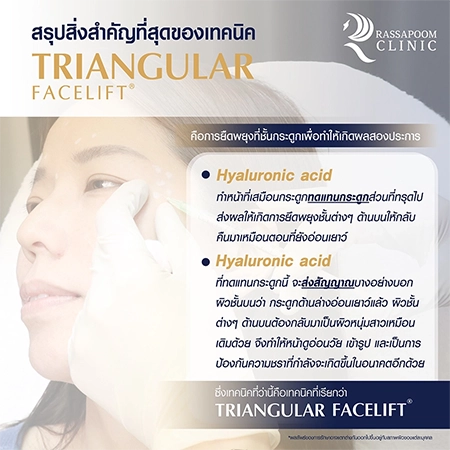 Triangular Face Lift คุณนก วาสนา