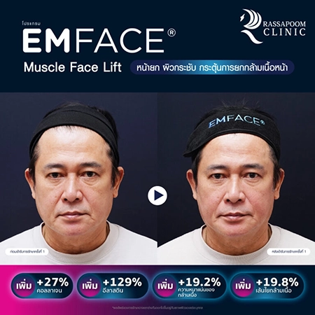 Emface (คุณหนุ่ม สันติสุข พรหมศิริ)