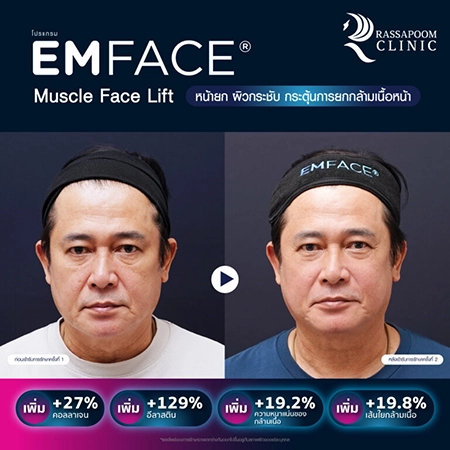 Emface (คุณหนุ่ม สันติสุข พรหมศิริ)