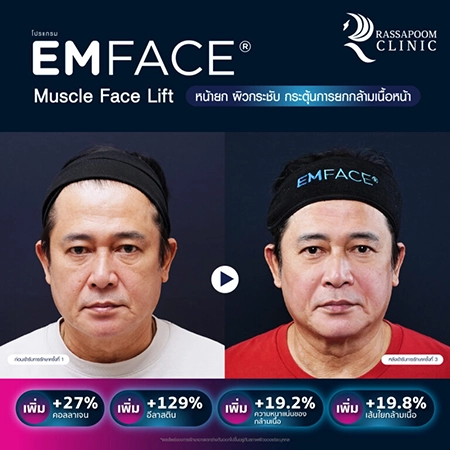 Emface (คุณหนุ่ม สันติสุข พรหมศิริ)