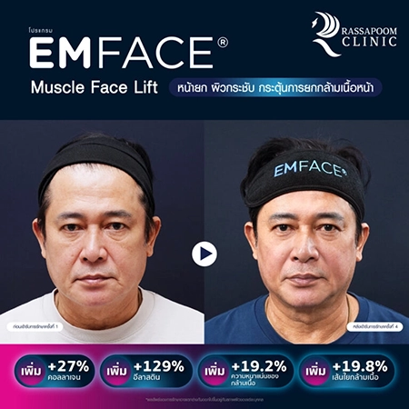 Emface (คุณหนุ่ม สันติสุข พรหมศิริ)