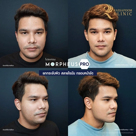 Morpheus Pro (คุณเกิ้ล)