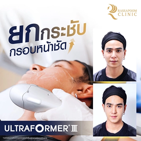 Ultraformer III (คุณโต๊ส อัครัช จิตตะศิริ)