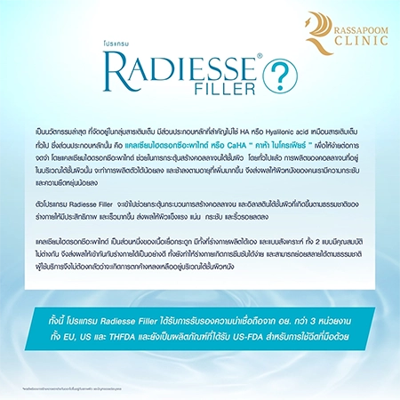 Radiesse Filler