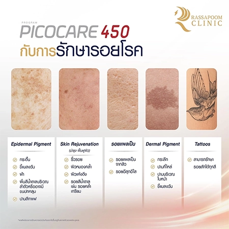 Picocare 450 Laser