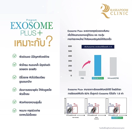 Exosome Plus+