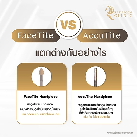 ดูดไขมันเหนียง แก้ปัญหาคางสองชั้น FaceTite AccuTite