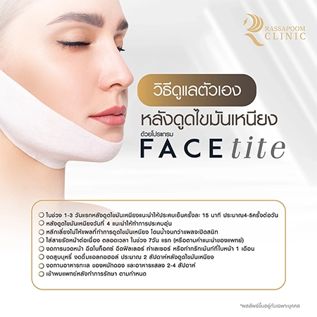 ดูดไขมันเหนียง แก้ปัญหาคางสองชั้น FaceTite AccuTite