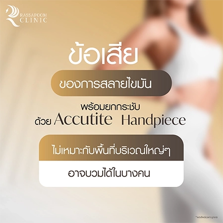 ดูดไขมันเหนียง แก้ปัญหาคางสองชั้น FaceTite AccuTite