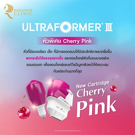 Ultraformer III ยกกระชับ ลดริ้วรอย สลายไขมันใต้ชั้นผิว