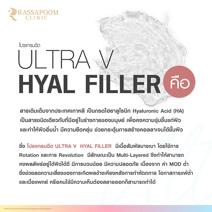 Ultra V Hyal Filler