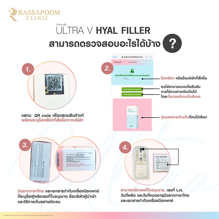 Ultra V Hyal Filler