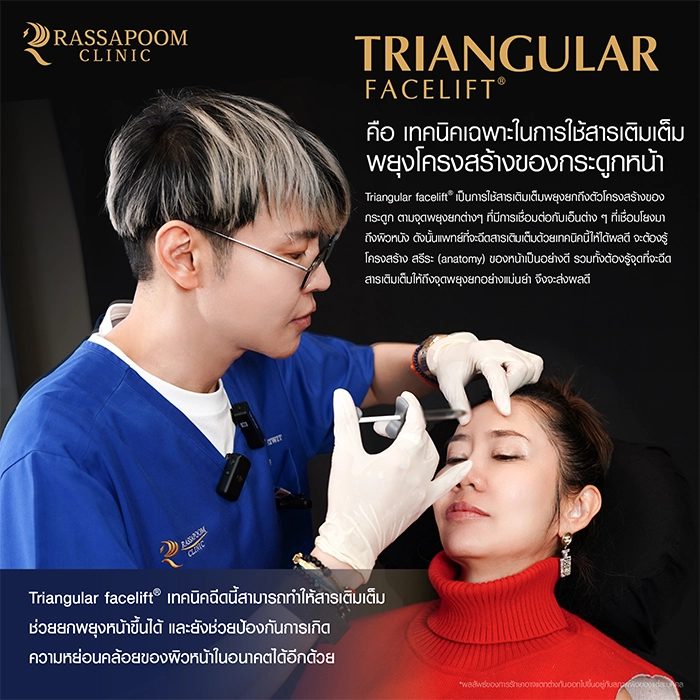 ฉีดฟิลเลอร์ (Triangular Face Lift)