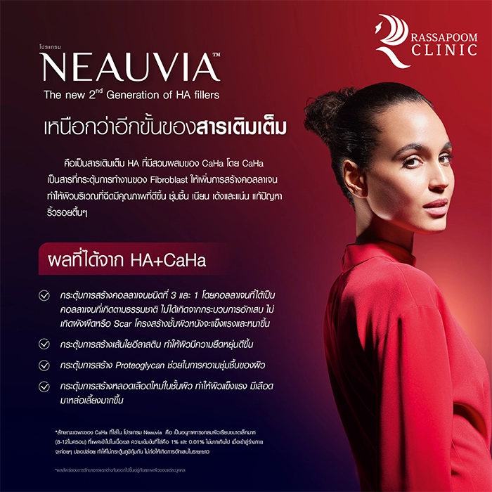 Neauvia ฟิลเลอร์