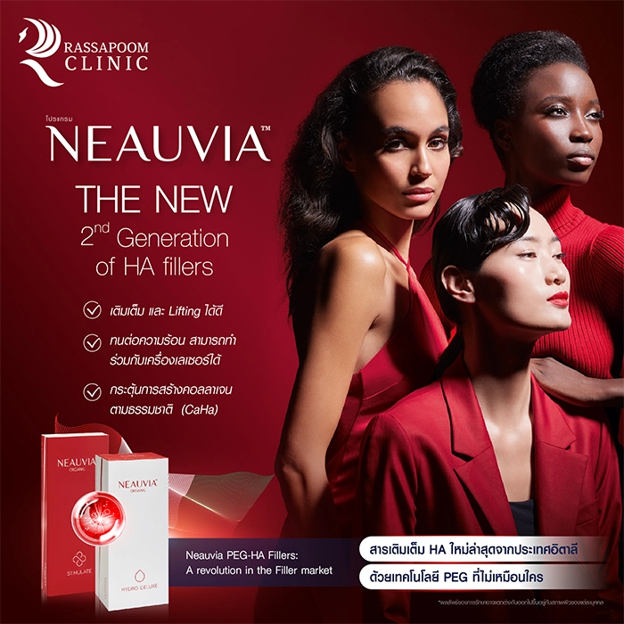 Neauvia ฟิลเลอร์