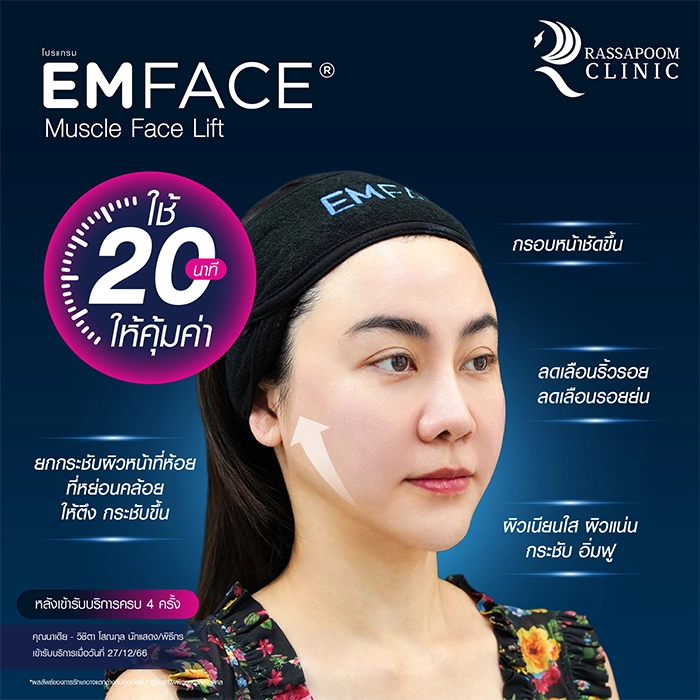 EMFACE คุณนาเดีย วิชิตา โสณกุล