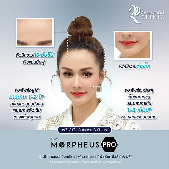 Morpheus Pro คุณบี กมลาสน์ เอียดศรีชาย