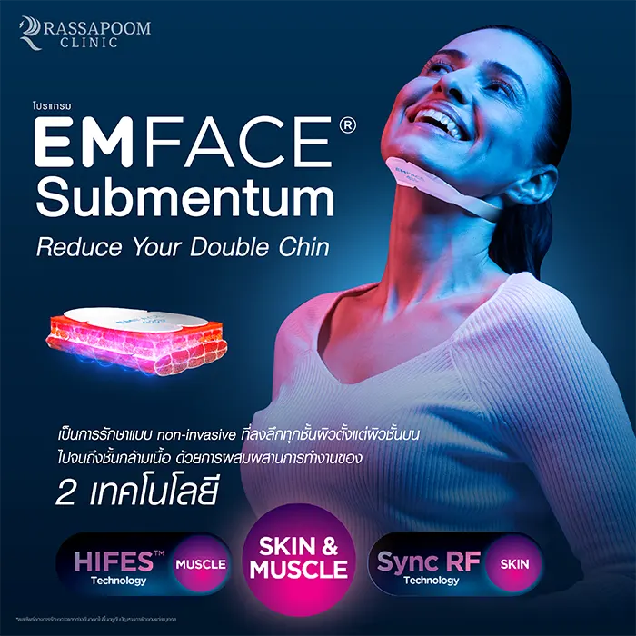 EMFACE Submentum ลดเหนียง