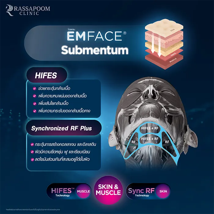 EMFACE Submentum ลดเหนียง