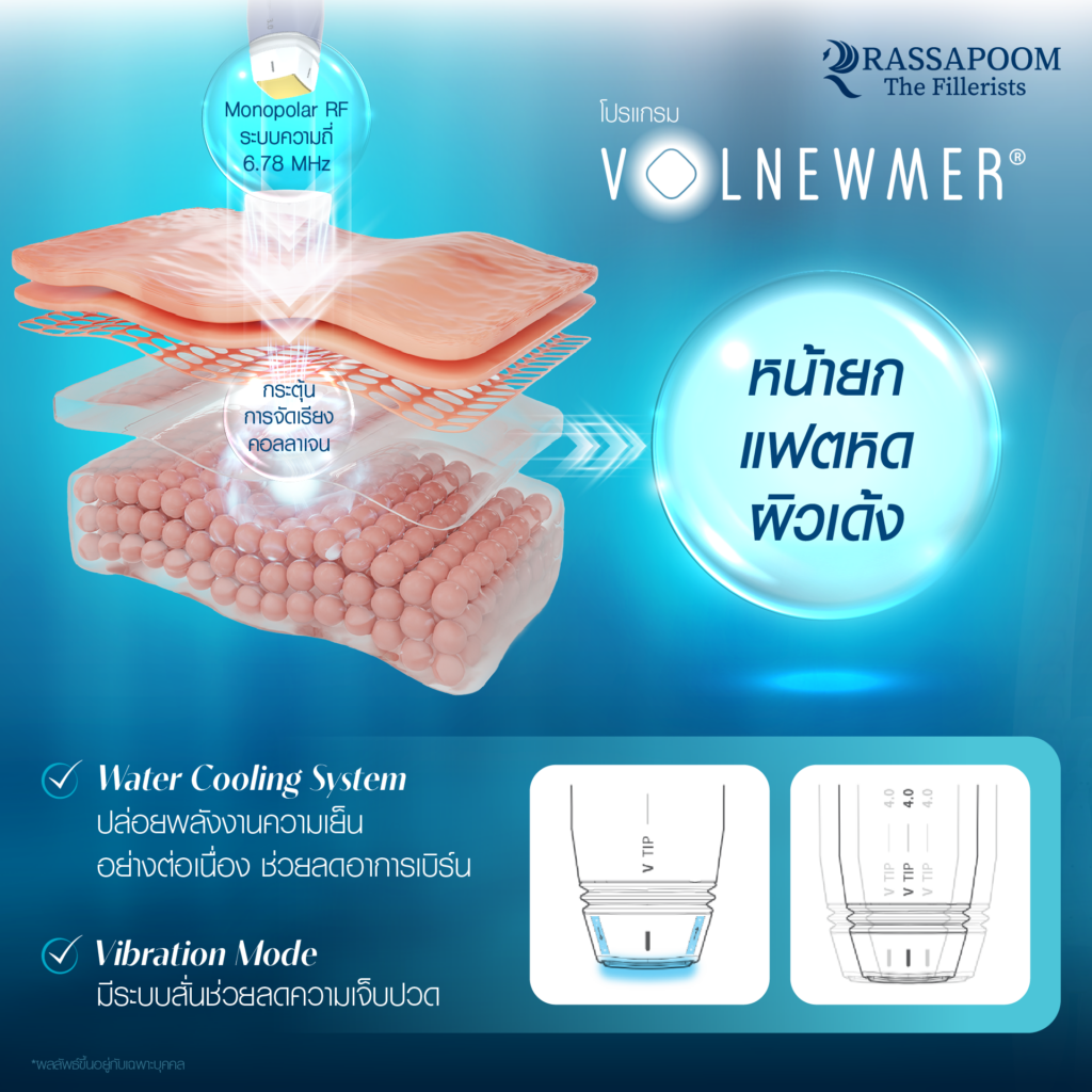 Volnewmer ช่วยเรื่องอะไร