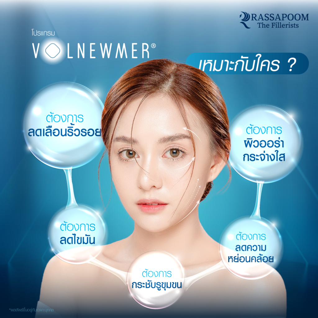 Volnewmer เหมาะกับใคร